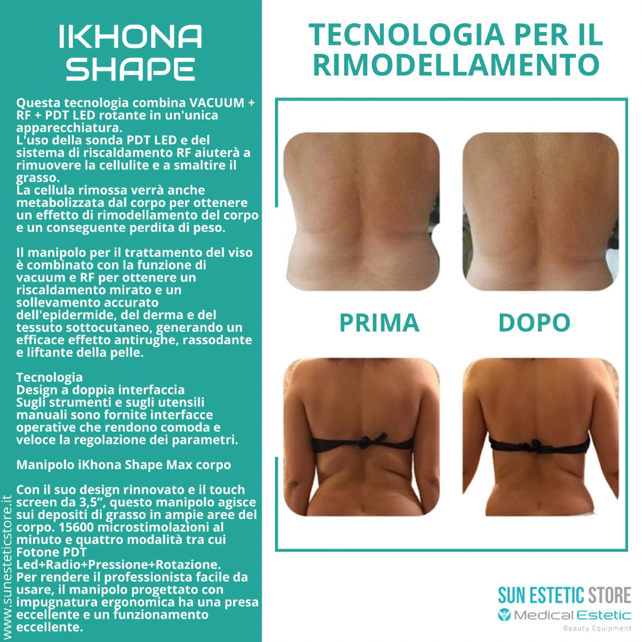 IKHONA SHAPE TECNOLOGIA ESTETICA PER IL RIMODELLAMENTO