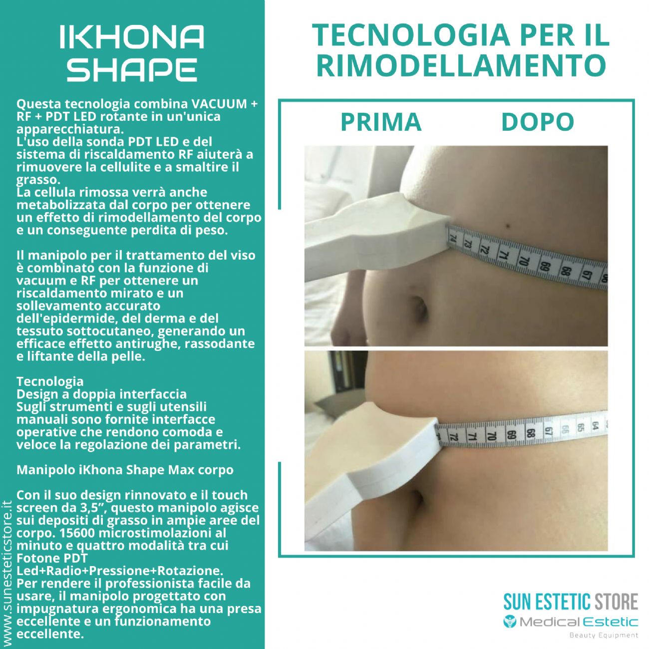 IKHONA SHAPE TECNOLOGIA ESTETICA PER IL RIMODELLAMENTO